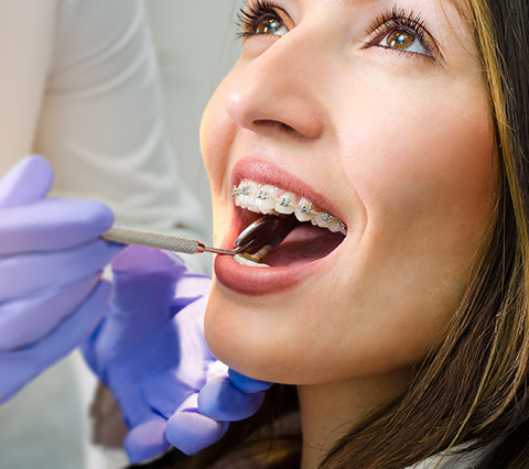 Paciente de ortodoncia en Las Condes en limpieza dental