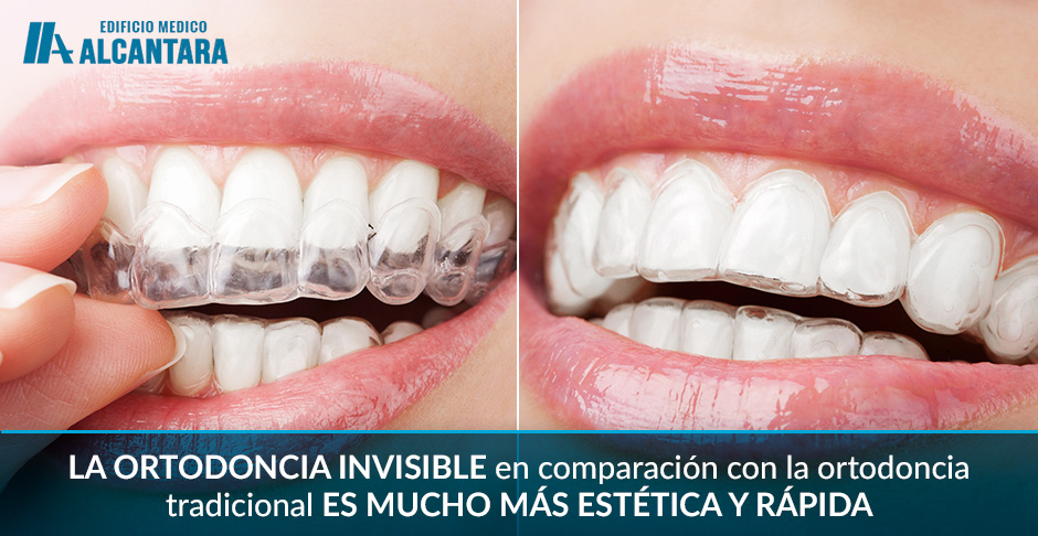 Tratamiento de Ortodoncia Invisible en Mujer 