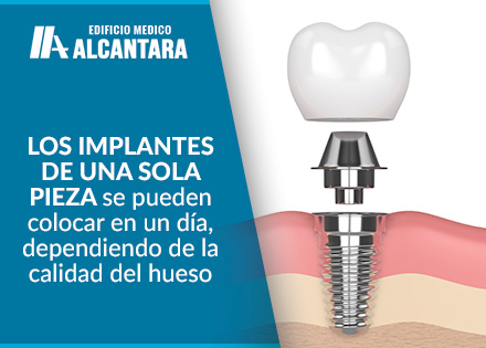 Tipos de Implantes Dentales Mandbula Modelo