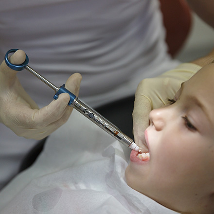 La Sedacin Dental Infantil Prcticada a una Nia