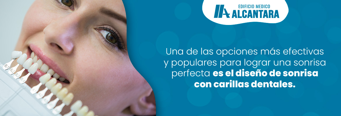 Diseño de Sonrisa con Carillas Dentales: La Mejor Opción para una Sonrisa Perfecta