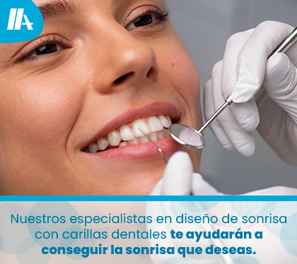 Diseo de Sonrisa con Carillas Dentales