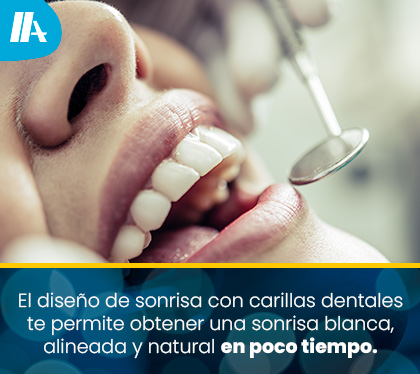 Evaluación para Diseño de Sonrisa con Carillas Dentales