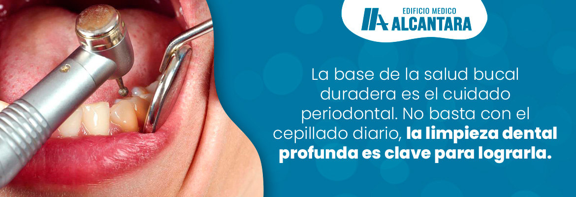 Descubre la Importancia de la Limpieza Dental Profunda: el Cuidado Periodontal para Encas Sanas