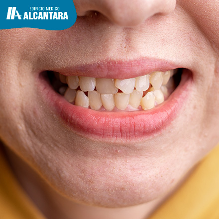 Adis a los Dientes Mal Posicionados! La Ortodoncia Avanzada que no Sabas que Exista en Santiago