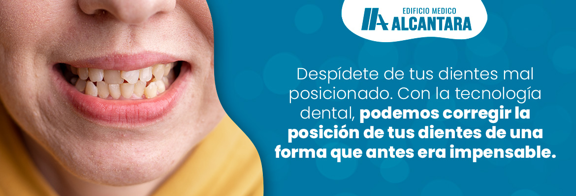 Adis a los Dientes Mal Posicionados! La Ortodoncia Avanzada que no Sabas que Exista en Santiago