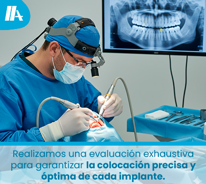 Especialista en Implantes Dentales en Chile