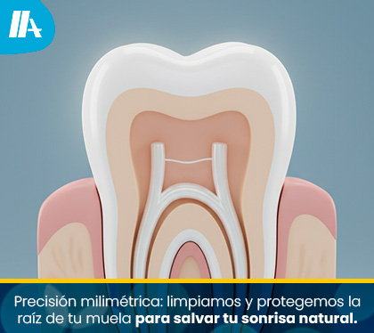 Imagen de la Anatomía de un Diente que Necesita Sesiones se Necesitan para una Endodoncia