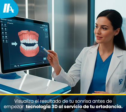 Escaneo ED para Frenillos Invisibles (Invisalign)
