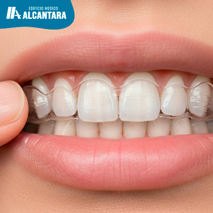 Frenillos Invisibles (Invisalign) y Funcionan