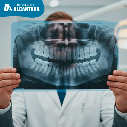 Fotograf�a de perfil o plano cerrado de un profesional sosteniendo una radiograf�a panor�mica donde se aprecia claramente un tercer molar inclinado presionando la muela vecina.
