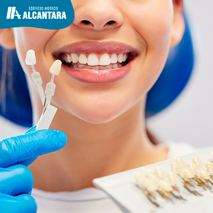 Muestra f�sica de l�minas ultrafinas de carillas de cer�mica sobre una superficie neutra junto a muestras de resina est�tica, resaltando traslucidez y textura.