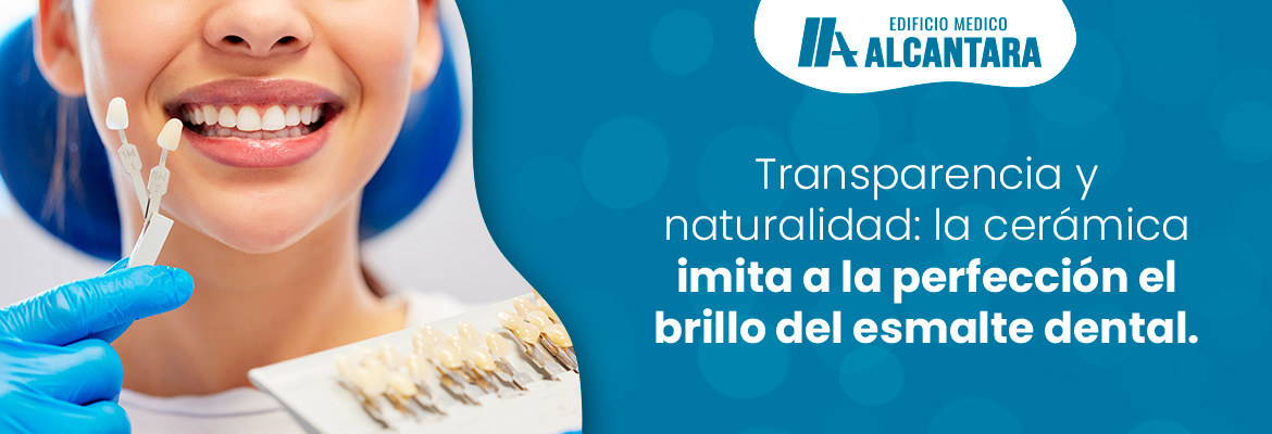 Muestra f�sica de l�minas ultrafinas de carillas de cer�mica sobre una superficie neutra junto a muestras de resina est�tica, resaltando traslucidez y textura.