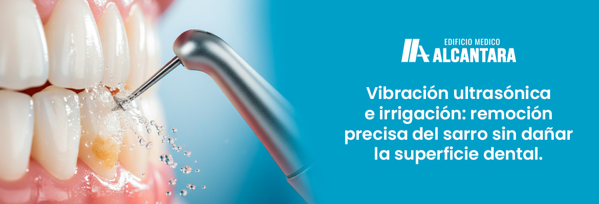 Limpieza Dental Profunda (Destartraje): Por Qu� es Clave y Cada Cu�nto Hacerla