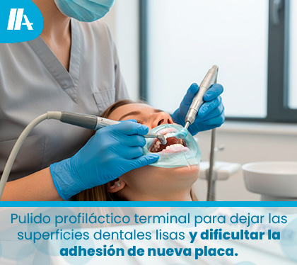 Higienista o dentista aplicando pasta profil�ctica con un cepillo rotatorio de copa suave para eliminar manchas superficiales de t� o caf�.