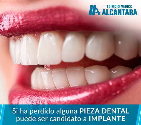 Sonrisa con implantes dentales en Santiago