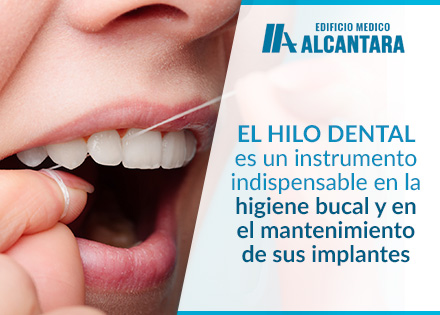 Implantes Dentales Limpieza con Hilo Dental 