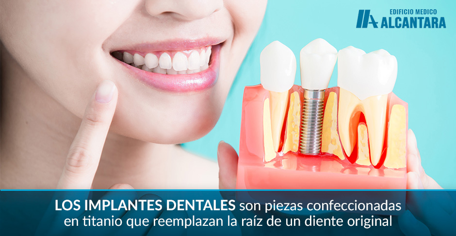 Implantes Dentales Presentados por Doctora