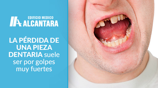 Dentista de Urgencias Hombre con Prdida de Pieza Dentaria 