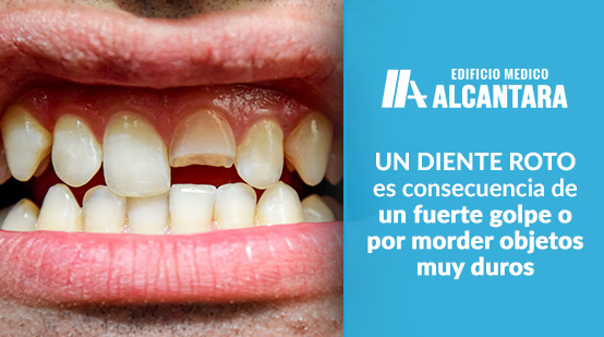 Dentista de Urgencia Hombre con Pieza Dentaria Rota 