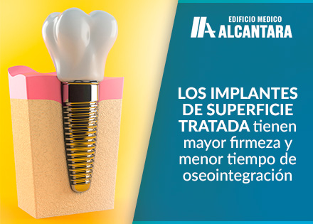 Render 3D de Tipos de Implantes Dentales de Superficie