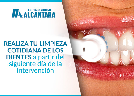 Implante Dental Higiene Bucal Chica Realizando Limpieza Dental