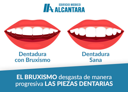 Dentadura con Bruxismo y Dentadura Sana Ilustracin