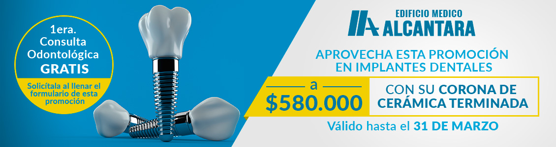 Promoción de Implantes Dentales a $580.000 con su Corona de Cerámica Terminada