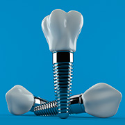 Promoción de Implantes Dentales a $580.000 con su Corona de Cerámica Terminada