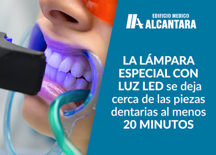 Blanqueamiento Dental LED Lmpara Especial en Piezas Dentarias de Mujer