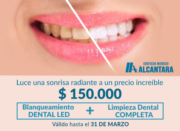 Promoción: Blanqueamiento Dental LED + Dental por $150.000