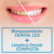 Promocin de Blanqueamiento Dental LED + Limpieza Dental Completa a $150.000
