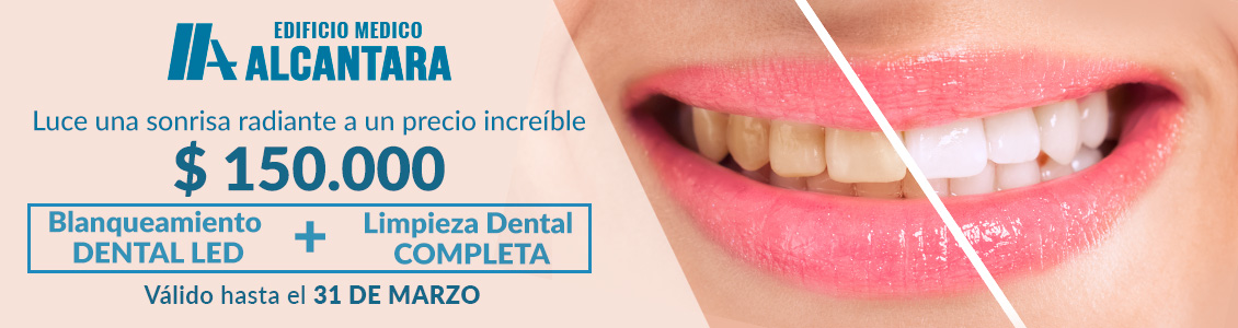 Promocin de Blanqueamiento Dental LED + Limpieza Dental Completa a $150.000