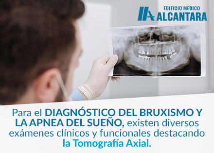 Tomografia para una Apnea de Sueo y Bruxismo evaluada por un Odontlogo.