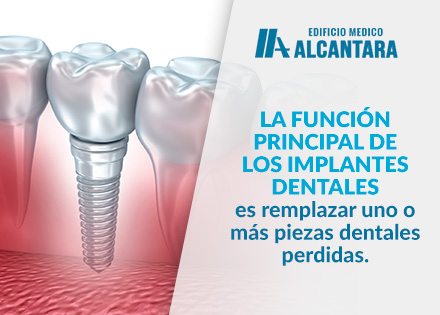 Ilustracin de Cunto Cuesta un Implante Dental