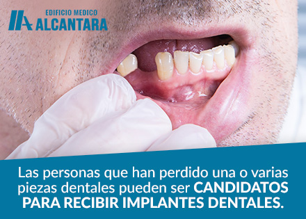 Hombre Que Quiere Saber Cuanto Cuesta un Implante Dental.