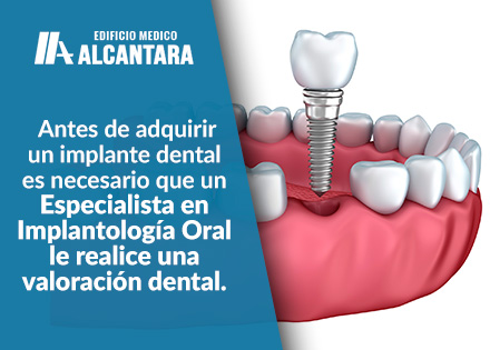 Animacin de Cunto Cuesta un Implante Dental.