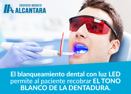 Hombre que muestra 5 Cosas que no Saba del Blanqueamiento Dental