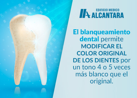 Ilustracin de las 5 Cosas que no Saba del Blanqueamiento Dental