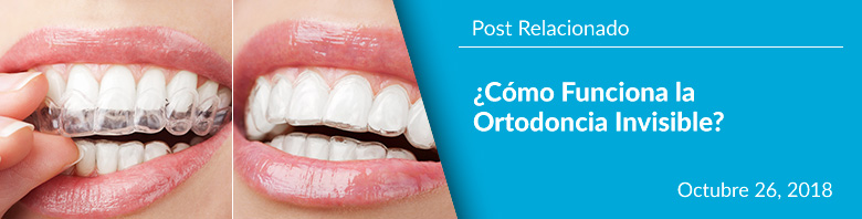 ¿Cómo Funciona la Ortodoncia Invisible? - Post Relacionado